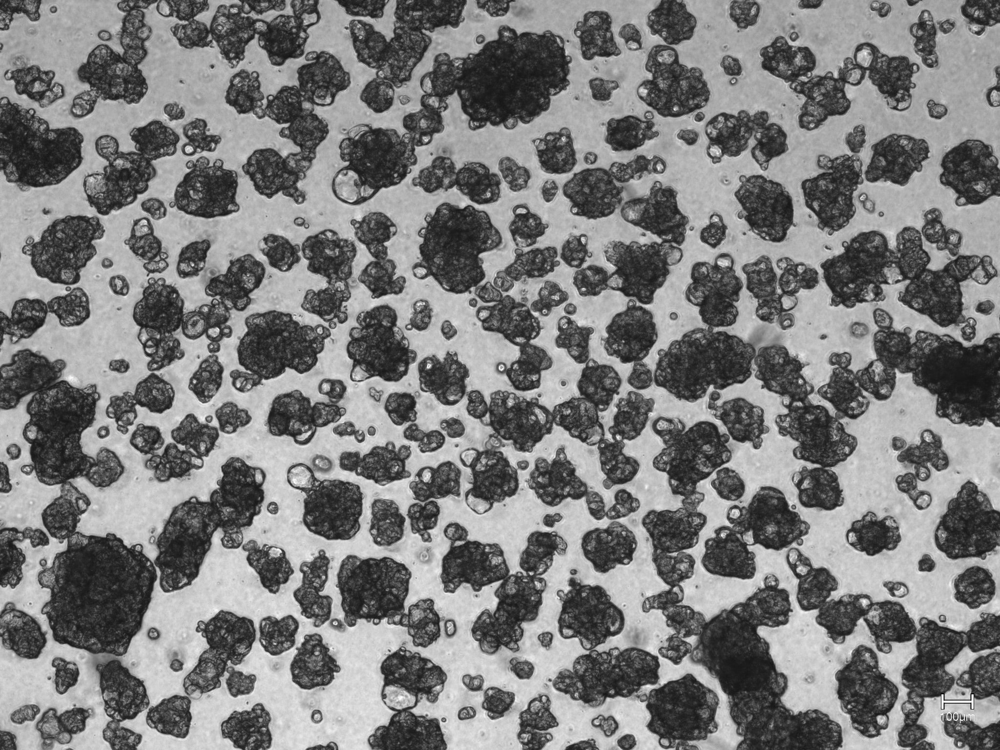 Oncosyne Expands Pancreatic Cancer Patient Cohort to Strengthen Translational Research